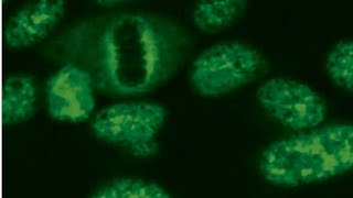 Detection Antinuclear AntibodyANAby indirect immunofluorescence antibodies against nucleoplasm [upl. by Anitsihc]