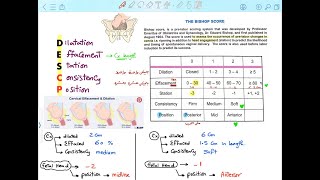 BISHOP SCORE Mnemonic Normal Labor [upl. by Can]