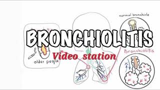 Bronchiolitis mrcpch Video station [upl. by Lemaj]