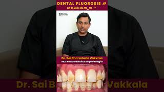 Dental Fluorosis Treatment teethstains healthchannel doctor dentist andhrapradesh hyderabad [upl. by Janeva]