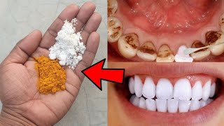 Teeth Whitening Formula at Home Naturally In just 2 minutes TURN YELLOW DIRTY TEETH TO PEARL WHITE [upl. by Ileek955]