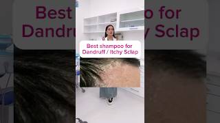 Right way to apply anti dandruff shampoo  part i  treatment of dandruff haircare DrMigraine [upl. by Ryann618]