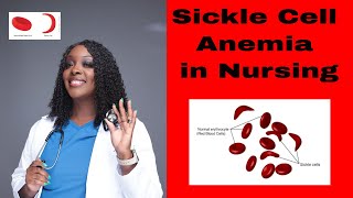 Living with and Managing Sickle Cell Disease [upl. by Carol-Jean]