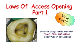 LAWS OF ACCESS CAVITY PREPARATION  DR NISHA GARGS DENTAL ACADEMY [upl. by Kcirtap]