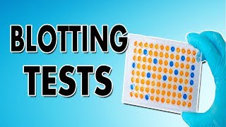 Blotting Techniques Western Blot Southern Blot and Northern Blot [upl. by Hallimaj]