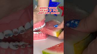 5 FOODS to AVOID if you just got BRACES put ON braces foodasmr satisfying [upl. by Fernande]