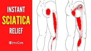 How to Instantly Fix Sciatica Pain [upl. by Stubbs981]