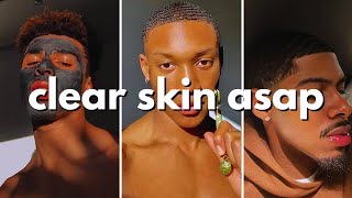 how to get clear skin for guys asap no bs guide [upl. by Shel]