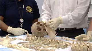 Medical Examiner System Evidence Guidelines [upl. by Dorry]