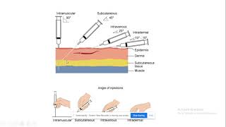 Liquid dosage forms Parenteral preparations Types according to the route of administration [upl. by Sclater782]