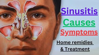 Sinusitis Infection  Symptoms Causes amp Treatment options [upl. by Aihsetan]