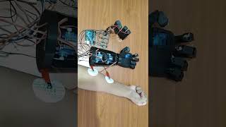 MechaFist  EMG Controlled Bionic Arm for Amputees robotics medical engineering electronics [upl. by Armbruster]