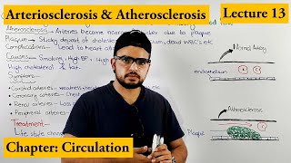 Arteriosclerosis amp Atherosclerosis CardioVascularDisorder  Chapter circulation Video  13 [upl. by Zechariah]