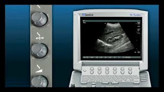 Basics of Ultrasonography [upl. by Awahsoj]