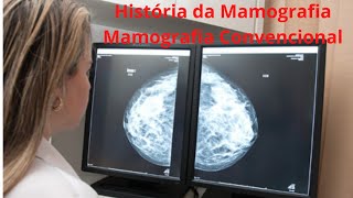 História da Mamografia Convencional [upl. by Marou]