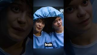 The twins shared a brain for 18 years shorts [upl. by Aimo]