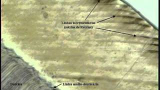 histologia del diente seccion Dwmv [upl. by Mettah]