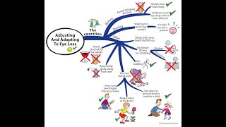Adjusting to Eye Loss Pt 1  The Operation [upl. by Haikan]