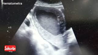 Ultrasound video showing Hematometra [upl. by Lem]