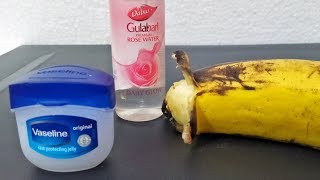 Remove Skin Pigmentation Using VASELINE ROSE WATER amp BANANAS  Simple Skin Care Beauty Hacks amp Tips [upl. by Oiligriv241]