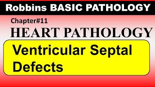 Chp11 Robbins Patho  Heart Pathology  Ventricular Septal Defect [upl. by Eelyme687]