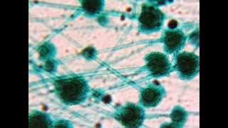 Gießkannenschimmel  Aspergillus   Mikroskop HD Video Deutsch [upl. by Orecic714]