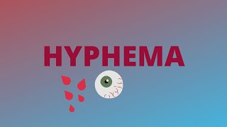 Hyphema  Definition Clinical FeaturesCauseComplicationTreatmentBlack ball 8  Ophthalmology [upl. by Jovitta117]