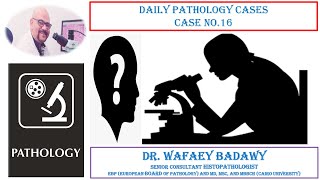 DAILY PATHOLOGY CASES CASE NO 16 BY DR WAFAEY BADAWY [upl. by Chery]