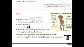 MBD4osteoporosis and osteomalacia [upl. by Daniella]