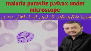 malaria under microscope plasmodium vivax under microscope [upl. by Sucul]