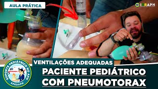 Como Ventilar uma Criança  Descompressão Torácica por Agulha no Pneumotórax Hipertensivo Prática [upl. by Socrates]