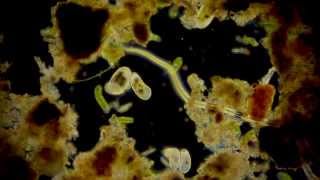 🔬 Mikroorganismen  microorganisms  Leben in der Pfütze  life dark field microscope [upl. by Hannie]