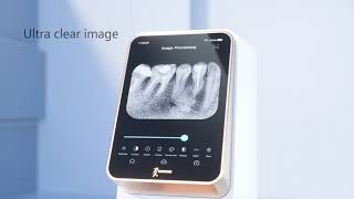 the PSP Scanner dental iScan of Woodpecker [upl. by Childs186]