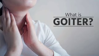 What is goiter  what is goiter disease  what is goiter thyroid  what is goiter symptoms [upl. by Lednahs25]