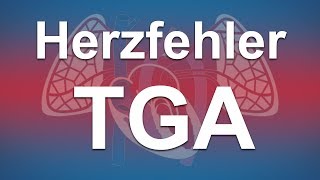 Herzfehler einfach erklärt Transposition der großen Arterien TGA [upl. by Darill]