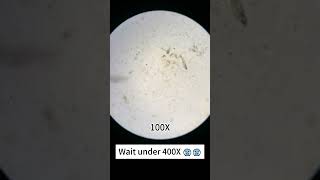 Spoiled mango look cool at 400x magnification underthemicroscope microscope science shorts [upl. by Ploch]