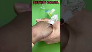 butterfly cannula kaise lagate hain shots shorts trending [upl. by Calore736]