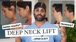 Deep Neck Lift everything you need to know [upl. by Sirotek]