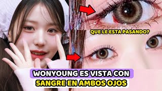 WONYOUNG ES VISTA CON SANGRE EN AMBOS OJOS  FANS CRITICAN A SU COMPAÑIA POR HACERLA TRABAJAR [upl. by Harobed]