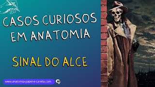 Casos Curiosos em Anatomia 5  Sinal do Alce  Agenesia do Corpo Caloso [upl. by Maren]