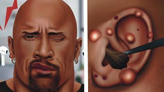 ASMR Ear Stone Removal  Ear Cleaning Animation 귀 청소 asmr careasmr [upl. by Ahsimot244]