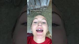 Orthodontist Reacts 2 front teeth pulled Or cap 🧢 braces [upl. by Minoru]