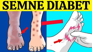 7 SEMNE NOCTURNE ALE DIABETULUI ZAHARAT PE CARE NU TREBUIE SĂ LE IGNORI [upl. by Ithaman]