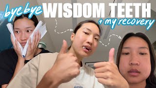 GETTING ALL MY WISDOM TEETH REMOVED surgery recovery vlog [upl. by Grega]