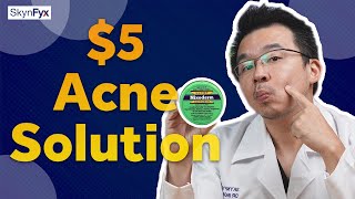 5 Acne Treatment  Cheapest Way To Get Rid Of Acne [upl. by Keligot993]