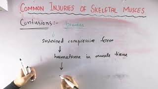 Contusions  Common injuries of skeletal muscle  Biomechanics of skeletal muscle [upl. by Siekram889]