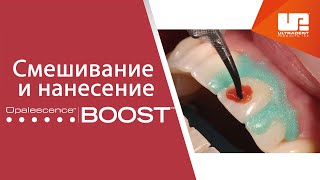 Смешивание и нанесение офисного отбеливания Opalescence™ Boost™ [upl. by Nairim727]