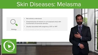 Skin Diseases Melasma Chloasma – Pathology  Lecturio [upl. by Nivlad302]