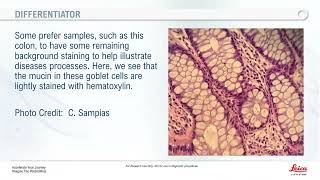 Fundamentals of Hematoxylin and Eosin Staining [upl. by Eeniffar683]