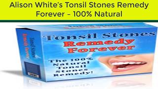 Tonsil Stones Remedy Forever review [upl. by Ferriter]